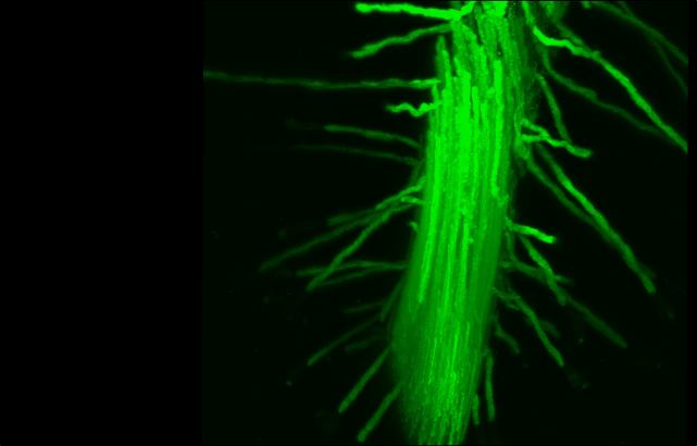 转基因拟南芥根系从轻薄的纸张显微镜表达膜标记的图像。