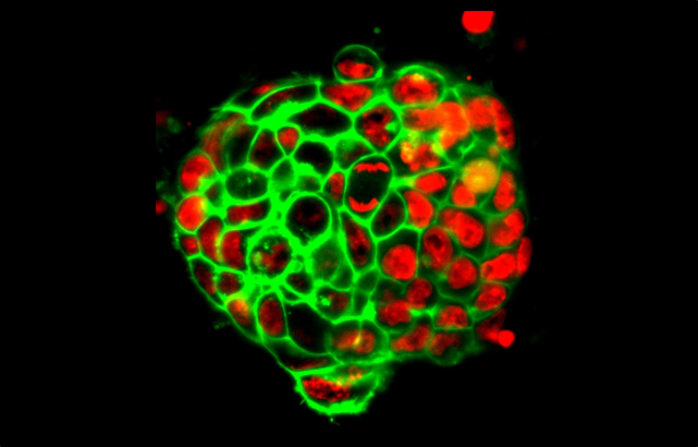 Colonies of mouse embryo stem cells imaged by light-sheet microscope