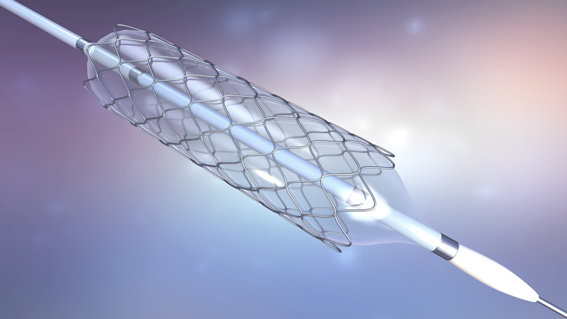 Medical-stents-STOCK