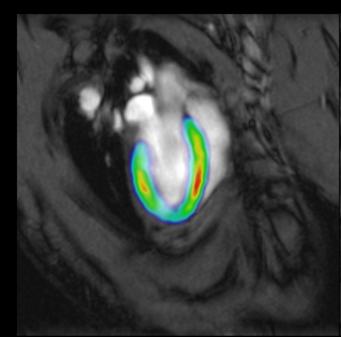 nuclear_molecular_imaging