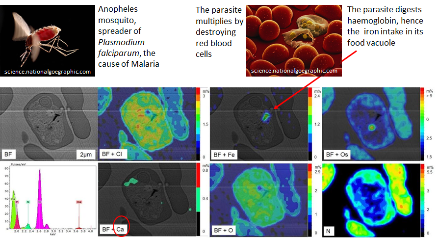 图1:树脂包埋的人血细胞感染了疟原虫