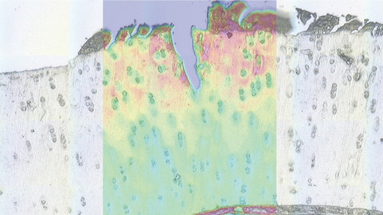 这是受损软骨组织切片的显微图像。低对比度图像通过叠加红外图像增强，显示蛋白质、脂类和碳水化合物。