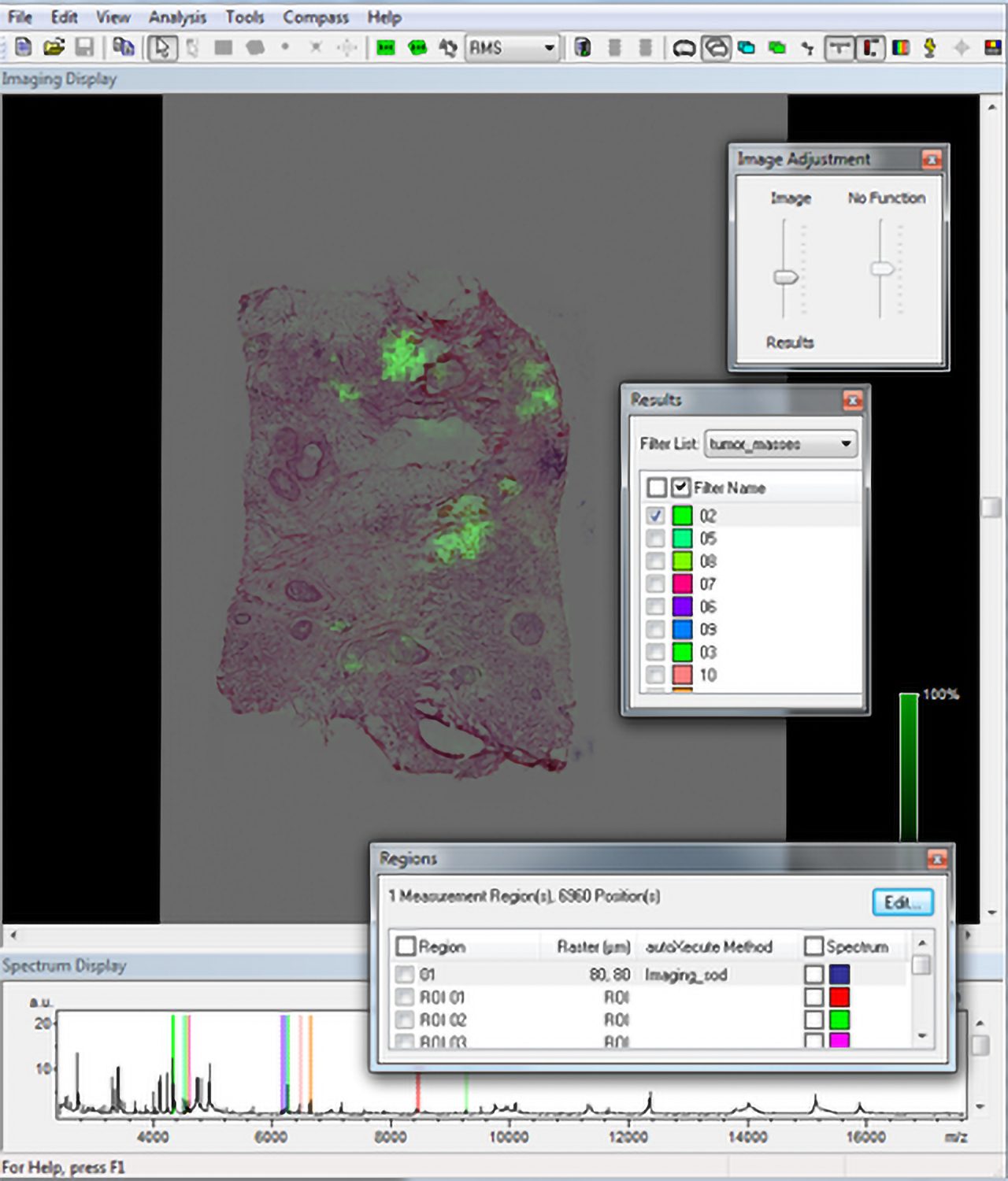 flexImaging中MALDI成像数据与虚拟显微镜载玻片叠加