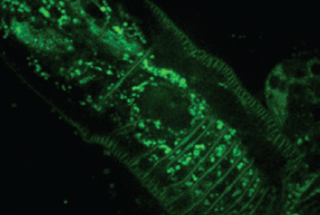 绿色荧光蛋白标记的线虫